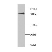 WB analysis of HeLa cells, using CENPC antibody (1/1000 dilution).