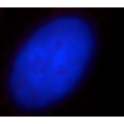 Centromere Protein J (CENPJ) Antibody