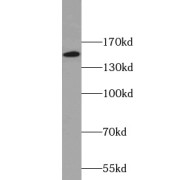 WB analysis of mouse testis tissue, using CENPJ antibody (1/500 dilution).