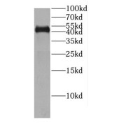 WB analysis of PC-3 cells, using CENPL antibody (1/300 dilution).