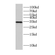 WB analysis of mouse brain tissue, using CENPO antibody (1/500 dilution).