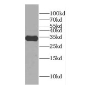 WB analysis of HEK-293T cells, using CENPP antibody (1/600 dilution).