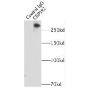 IP analysis of HeLa cells.