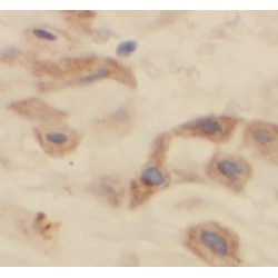 Centrosomal Protein 250 kDa (CEP250) Antibody