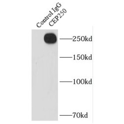 Centrosomal Protein 250 kDa (CEP250) Antibody