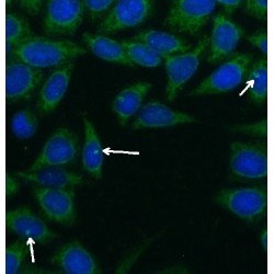 Centrosomal Protein 290 kDa (CEP290) Antibody