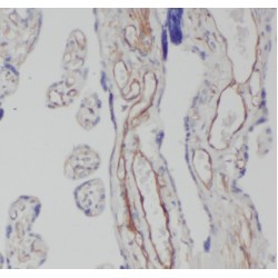 Centrosomal Protein 290 kDa (CEP290) Antibody