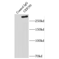 Centrosomal Protein 290 kDa (CEP290) Antibody