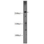 WB analysis of HeLa cells, using CEP290 antibody (1/600 dilution).