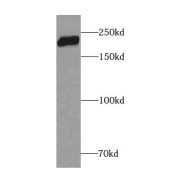 WB analysis of mouse heart tissue, using CEP350-Specific antibody (1/600 dilution).