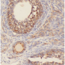 Centrosomal Protein 70 kDa (CEP70) Antibody