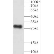 WB analysis of PC-3 cells, using CEP70 antibody (1/600 dilution).