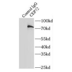 Centrosomal Protein 72 kDa (CEP72) Antibody