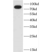 WB analysis of HeLa cells, using CEP72 antibody (1/1000 dilution).