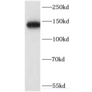 WB analysis of human blood tissue, using Ceruloplasmin antibody (1/1000 dilution).