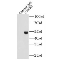 Complement Factor H Related 3 (CFHR3) Antibody