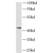 WB analysis of A549 cells, using CFHR3 antibody (1/2000 dilution).