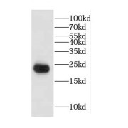 WB analysis of Jurkat cells, using CGGBP1 antibody (1/1000 dilution).