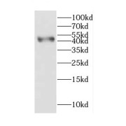 WB analysis of rat kidney tissue, using CGRRF1 antibody (1/600 dilution).