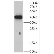 WB analysis of HeLa cells, using CHAD antibody (1/600 dilution).