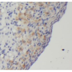 Chromatin Assembly Factor 1 Subunit A (CHAF1A) Antibody