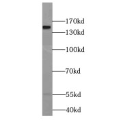 WB analysis of Jurkat cells, using CHAF1A antibody (1/2000 dilution).