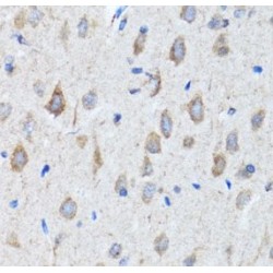 Choline O-Acetyltransferase (CHAT) Antibody