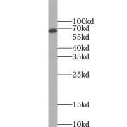 WB analysis of rat brain tissue, using CHAT antibody (1/1000 dilution).