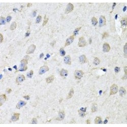 Coiled-Coil-Helix-Coiled-Coil-Helix Domain Containing 3 (CHCHD3) Antibody