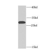 WB analysis of HeLa cells, using CHCHD3 antibody (1/1000 dilution).