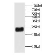 WB analysis of rat brain tissue, using CHCHD4 antibody (1/1500 dilution).