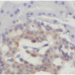 Coiled-Coil-Helix-Coiled-Coil-Helix Domain Containing Protein 7 (CHCHD7) Antibody