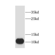 WB analysis of mouse pancreas tissue, using CHCHD7 antibody (1/500 dilution).