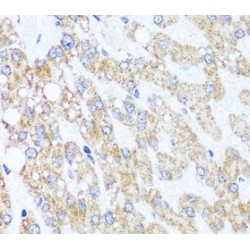 Chromodomain Helicase DNA Binding Protein 1 (CHD1) Antibody