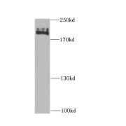 WB analysis of HeLa cells, using CHD1 antibody (1/1000 dilution).