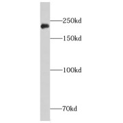 WB analysis of HEK-293 cells, using CHD3 antibody (1/600 dilution).