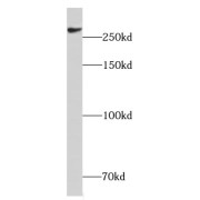 WB analysis of HeLa cells, using CHD4 antibody (1/500 dilution).