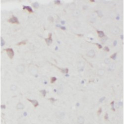 Calcium Homeostasis Endoplasmic Reticulum Protein (CHERP) Antibody