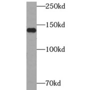 WB analysis of Jurkat cells, using CHERP antibody (1/1000 dilution).