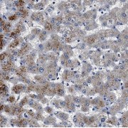 IHC-P analysis of human liver tissue, using CHI3L1 antibody (1/100 dilution).