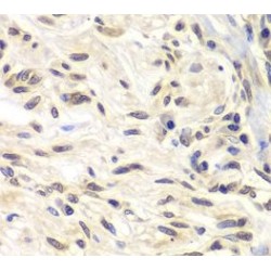 Serine/threonine-Protein Kinase Chk1 (CHK1) Antibody