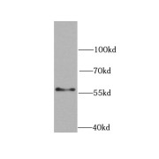 WB analysis of SW620 cells, using Chk1 antibody (1/1000 dilution).