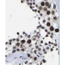 Serine/threonine-Protein Kinase Chk1 (Chk1) Antibody