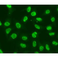 Serine/threonine-Protein Kinase Chk2 (CHK2) Antibody