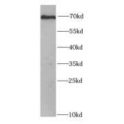 WB analysis of HeLa cells, using Chk2 antibody (1/1000 dilution).