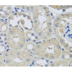 Charged Multivesicular Body Protein 1b (CHMP1B) Antibody