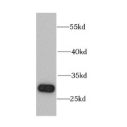 WB analysis of HeLa cells, using CHMP1B antibody (1/1000 dilution).