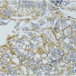 Charged Multivesicular Body Protein 4b (CHMP4B) Antibody