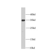 WB analysis of mouse heart tissue, using CHMP4B antibody (1/1000 dilution).