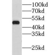 WB analysis of fetal human brain tissue, using CHN2 antibody (1/1000 dilution).